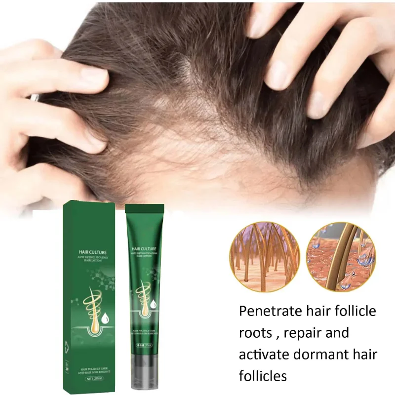 Óleo de Crescimento Capilar Rápido: Eficaz Contra Calvície e Perda de Cabelo Loja dos Cabelos: Peruca Cabelo Natural, Extensões, Cosméticos e