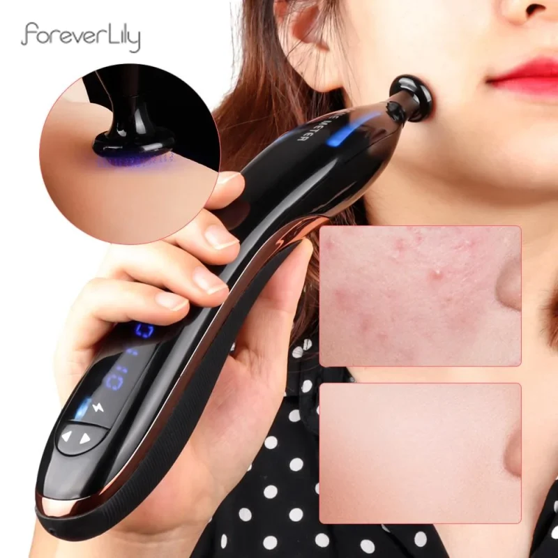 Cosméticos e outros produtos de beleza Blue Light Plasma Pen – Dispositivo de Beleza Avançado para Remoção de Cicatrizes e Acne, Tratamento Anti-Rugas e Rejuvenescimento Facial | Loja dos Cabelos