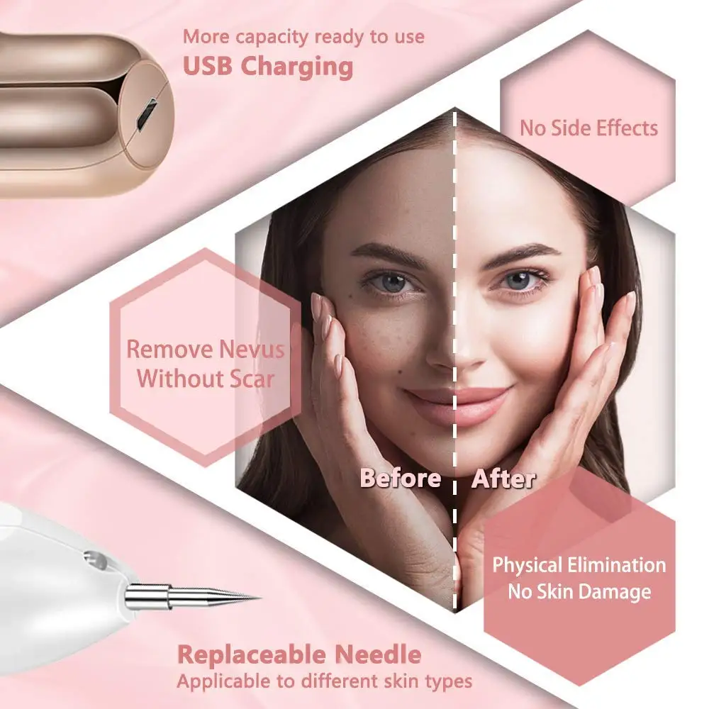 kf-U62c7b6a0d5a942b1987e547444bd6af2C-Port-til-LED-Spot-Removedor-Laser-Pen-Plasma-Pen-Skin-Label-Remo-o-Kit-Face-e
