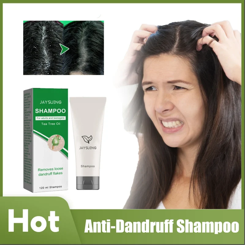Cosméticos e outros produtos de beleza Shampoo Anticaspa Seborréico, Tratamento Anti-Coceira, Controle de Óleo e Fortalecimento das Raízes do Cabelo | Loja dos Cabelos