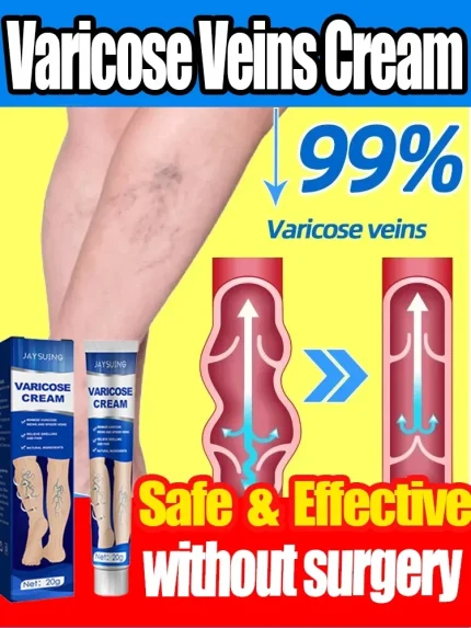 Cosméticos e outros produtos de beleza Compre Pomada para Varizes e Vasculite | Alívio da Dor, Trat | Loja dos Cabelos