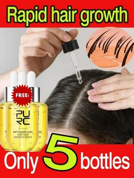 Cosméticos e outros produtos de beleza Compre Óleo de Gengibre para Crescimento Capilar Rápido – | Loja dos Cabelos