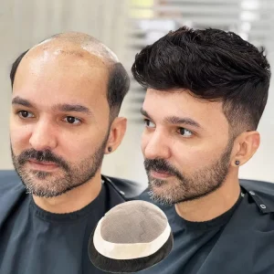Perucas Compre Peruca Masculina com Base Mono Durável e Contorno em | Loja dos Cabelos