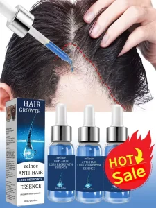 Cosméticos e outros produtos de beleza Óleo para Crescimento Capilar e Tratamento Antiqueda – Repara Cabelos Danificados e Pós-Química para Homens e Mulheres | Loja dos Cabelos