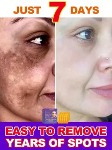 Cosméticos e outros produtos de beleza Sérum Rejuvenescedor Facial – Reduz Falhas e Revitaliza a Pele | Loja dos Cabelos