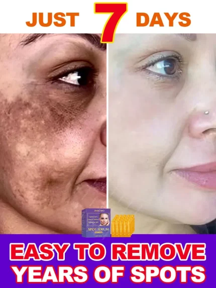 Cosméticos e outros produtos de beleza Sérum Rejuvenescedor Facial – Reduz Falhas e Revitaliza a Pele | Loja dos Cabelos